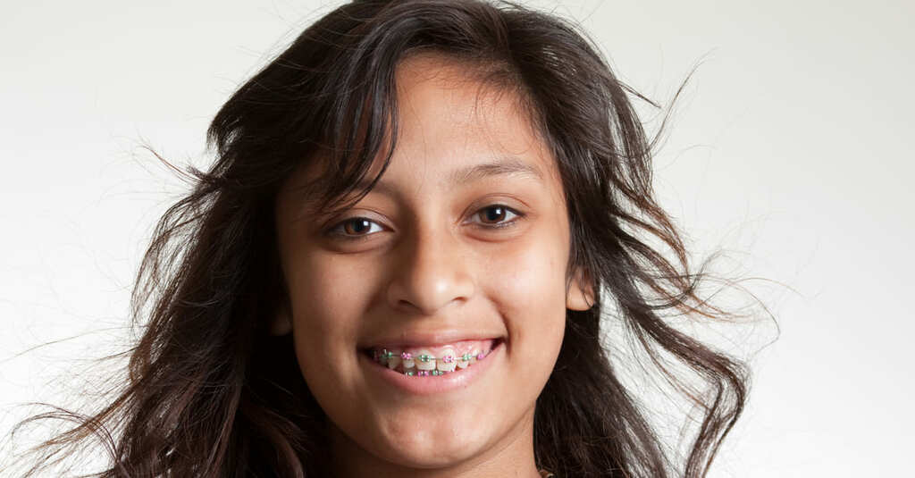 Jeune fille souriante avec bagues multicolors